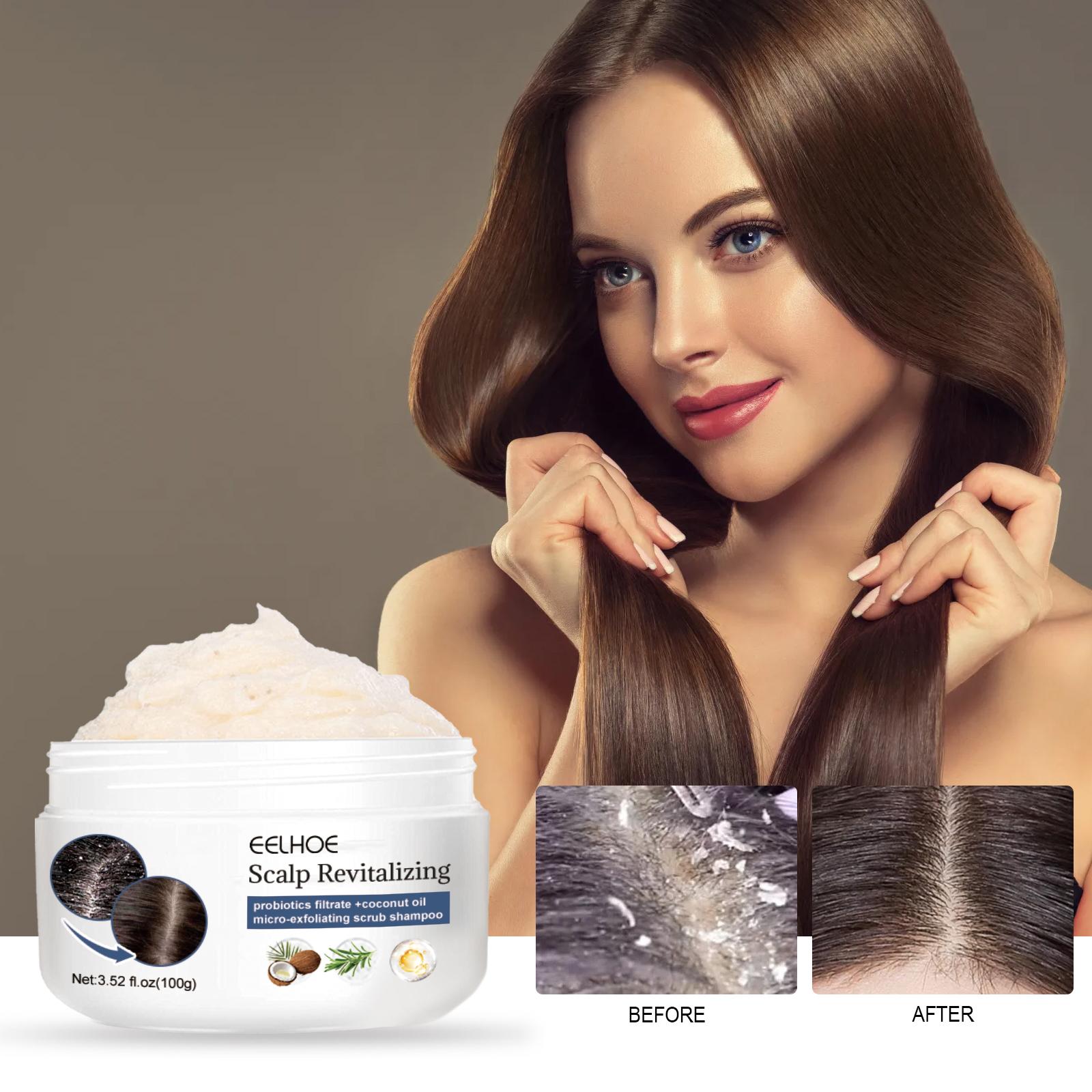 EELHOE Scalp Exfoliating Scrub Moisturizing Dry Hair Scalp Cleansing Treatment Refreshing Scrub
EELHOE Scalp Exfoliating Scrub Moisturizing Dry Hair Scalp Cleansing Treatment Refreshing Scrub