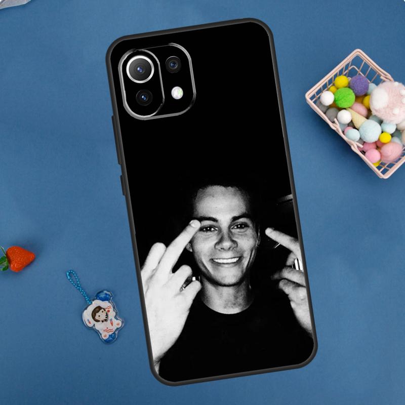 Dylan O Brien Teen Wolf Case For Xiaomi 14 13 15 Ultra 11T 12T 13T 14T Pro POCO X7 Pro X3 X5 F5 F6 M6 X6 Pro Cover POCO X6
Dylan O Brien Teen Wolf Case For Xiaomi 14 13 15 Ultra 11T 12T 13T 14T Pro POCO X7 Pro X3 X5 F5 F6 M6 X6 Pro Cover POCO X6