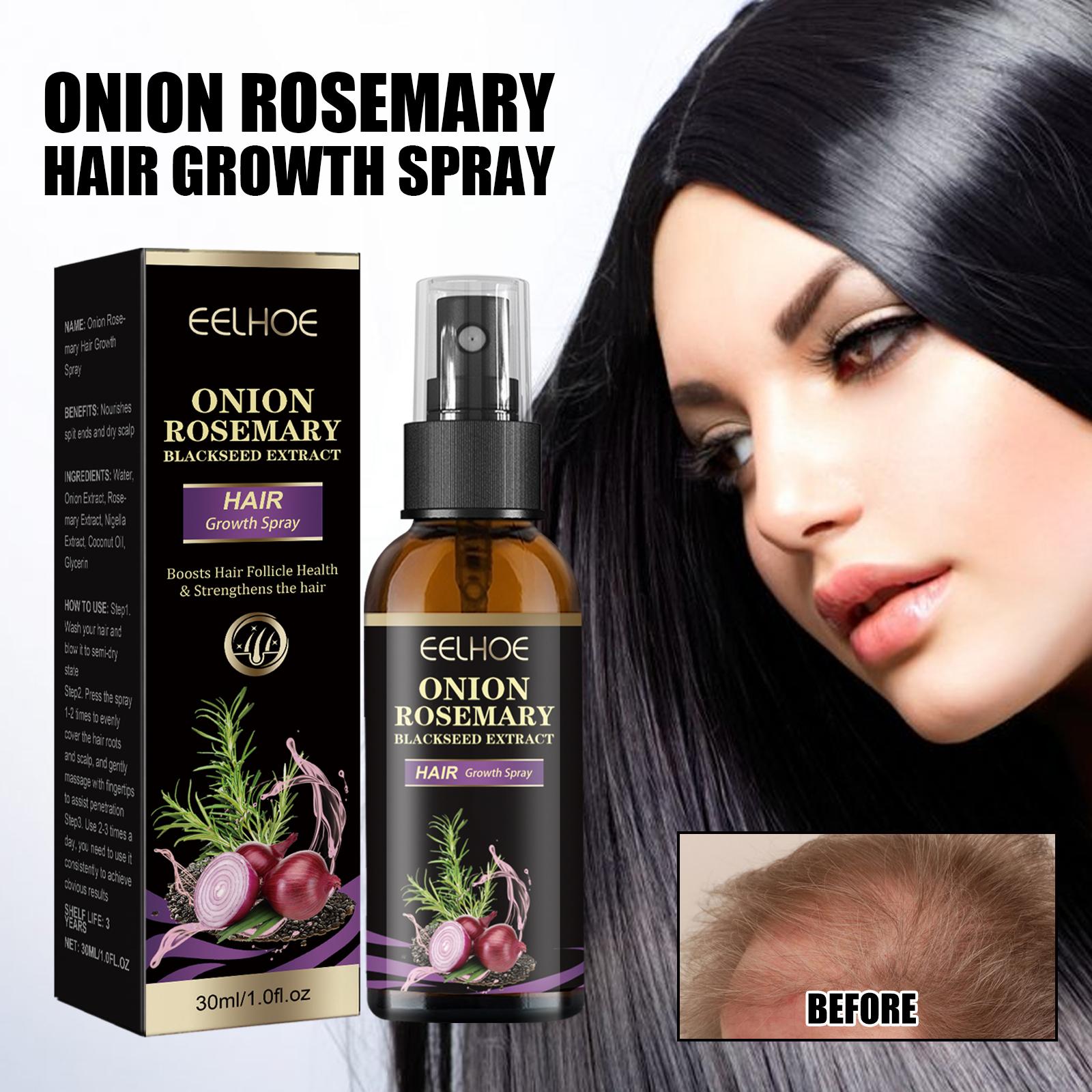 EELHOE Onion Rosemary Hair Spray Deep Moisturizing Scalp Smooth & Shine Hair Conditioning Spray
EELHOE Onion Rosemary Hair Spray Deep Moisturizing Scalp Smooth & Shine Hair Conditioning Spray