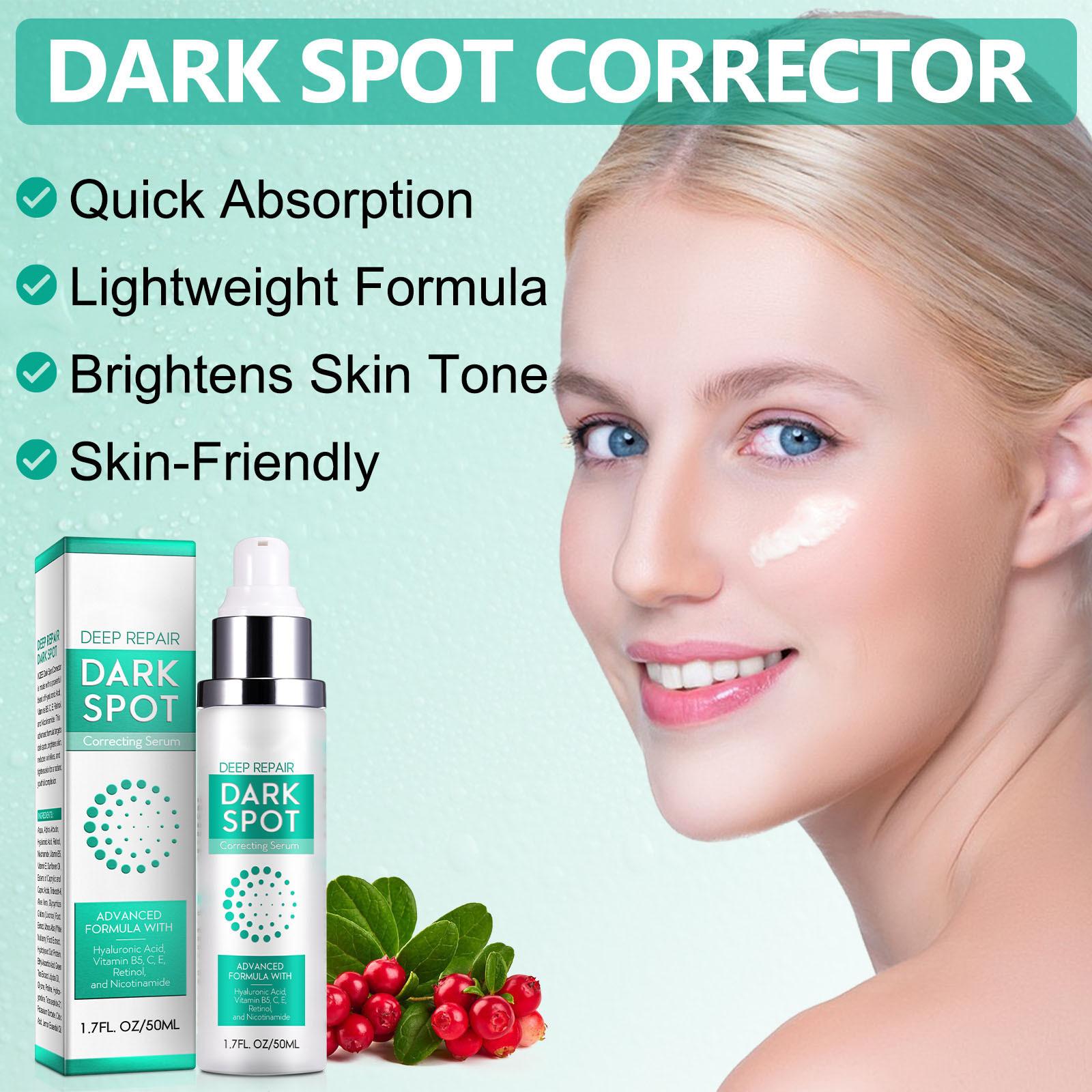 Anti-freckle Cream 50ml Control Pigment Reflux, Inhibits Melanin, Prevent Anti-blackening, Repairs Skin, Moisturizes And Hydrates One Size
Anti-freckle Cream 50ml Control Pigment Reflux, Inhibits Melanin, Prevent Anti-blackening, Repairs Skin, Moisturizes And Hydrates One Size