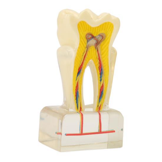 Dental Model Acrylic 6 Times Decayed Tooth Model Dental Education Supplies for Dentists Teaching
Dental Model Acrylic 6 Times Decayed Tooth Model Dental Education Supplies for Dentists Teaching