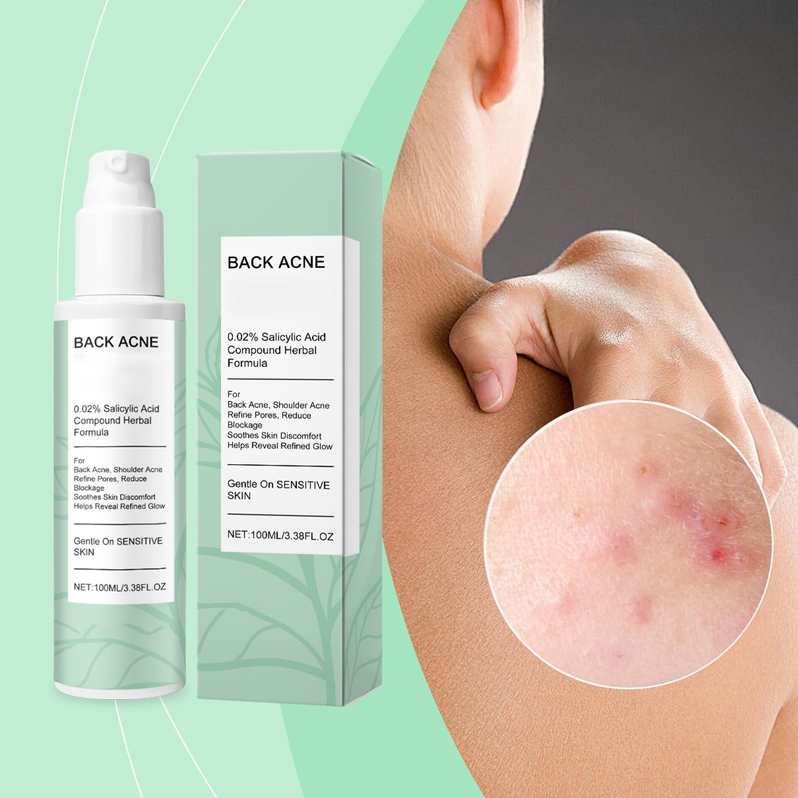 Back Body Care Spray Smoothing, Brightening, Refining Pores And Gentle Acne-prone Skin Care Spray100ml
Back Body Care Spray Smoothing, Brightening, Refining Pores And Gentle Acne-prone Skin Care Spray100ml