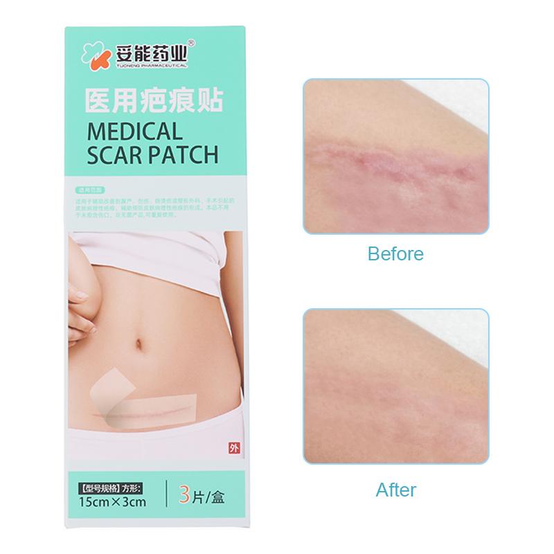 3Pcs Silicone Scar Patches Removal Invisible Concealer Pad Gel Waterproof Tape Treatment For C-Section Keloid Burns Tummy Tuck
3Pcs Silicone Scar Patches Removal Invisible Concealer Pad Gel Waterproof Tape Treatment For C-Section Keloid Burns Tummy Tuck