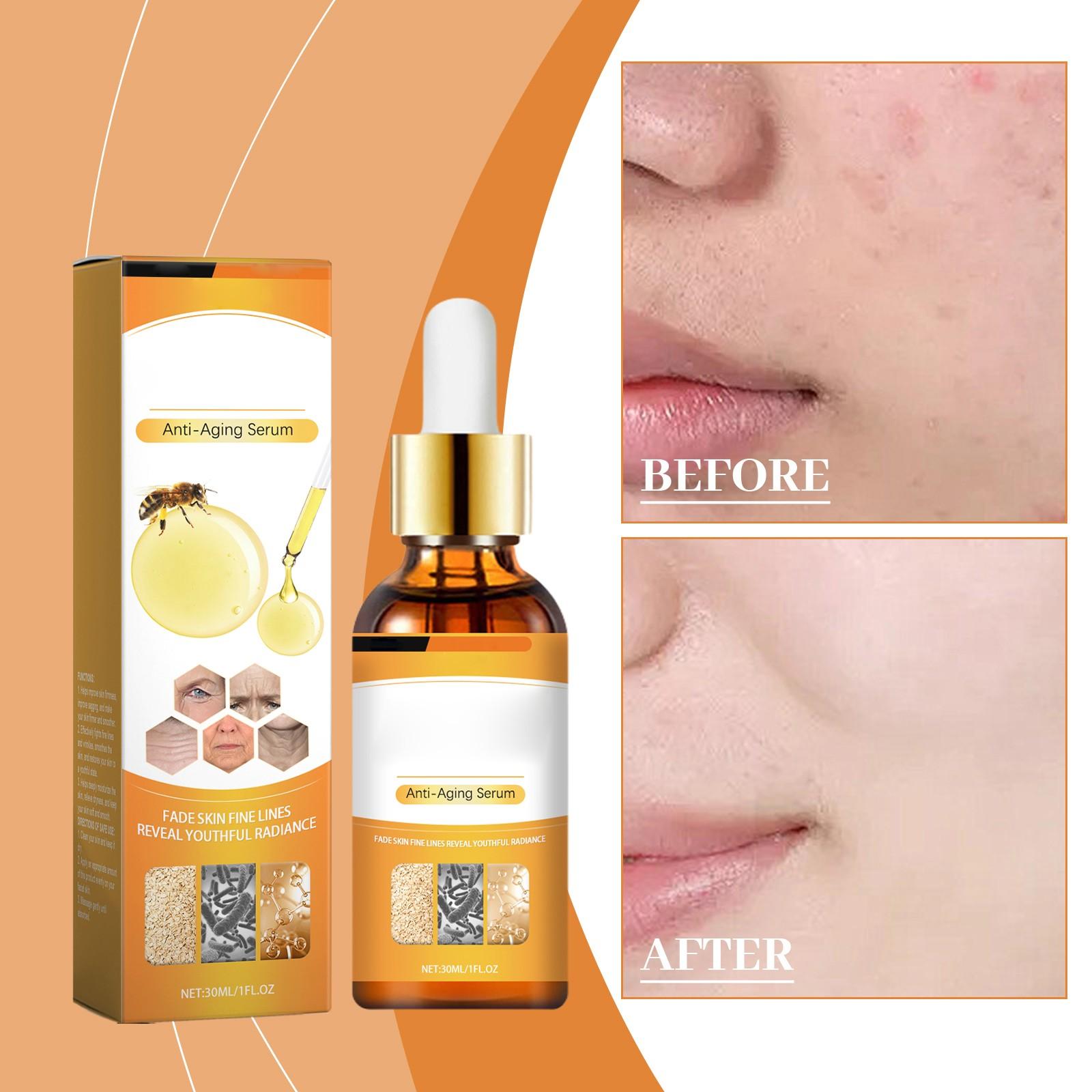 Bee Anti-Wrinkle And Firming Smooths The Skin, Deeply Hydrates And Moisturizes The Skin, Anti-aging, Firming, Gentle Skin Care, 30ml
Bee Anti-Wrinkle And Firming Smooths The Skin, Deeply Hydrates And Moisturizes The Skin, Anti-aging, Firming, Gentle Skin Care, 30ml
