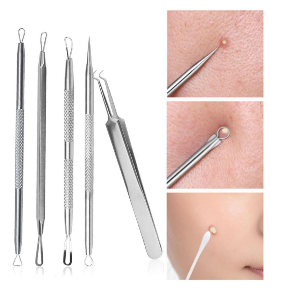 Набор инструментов для удаления угрей в коробке, пинцет из нержавеющей стали для прыщей, игла для лица от прыщей
Набор инструментов для удаления угрей в коробке, пинцет из нержавеющей стали для прыщей, игла для лица от прыщей