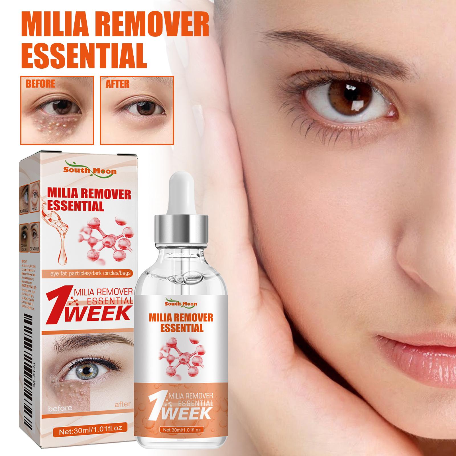 South Moon Cellulite Essence Nourishing & Moisturizing Skin Grain Treatment Essence for Eye Area
South Moon Cellulite Essence Nourishing & Moisturizing Skin Grain Treatment Essence for Eye Area