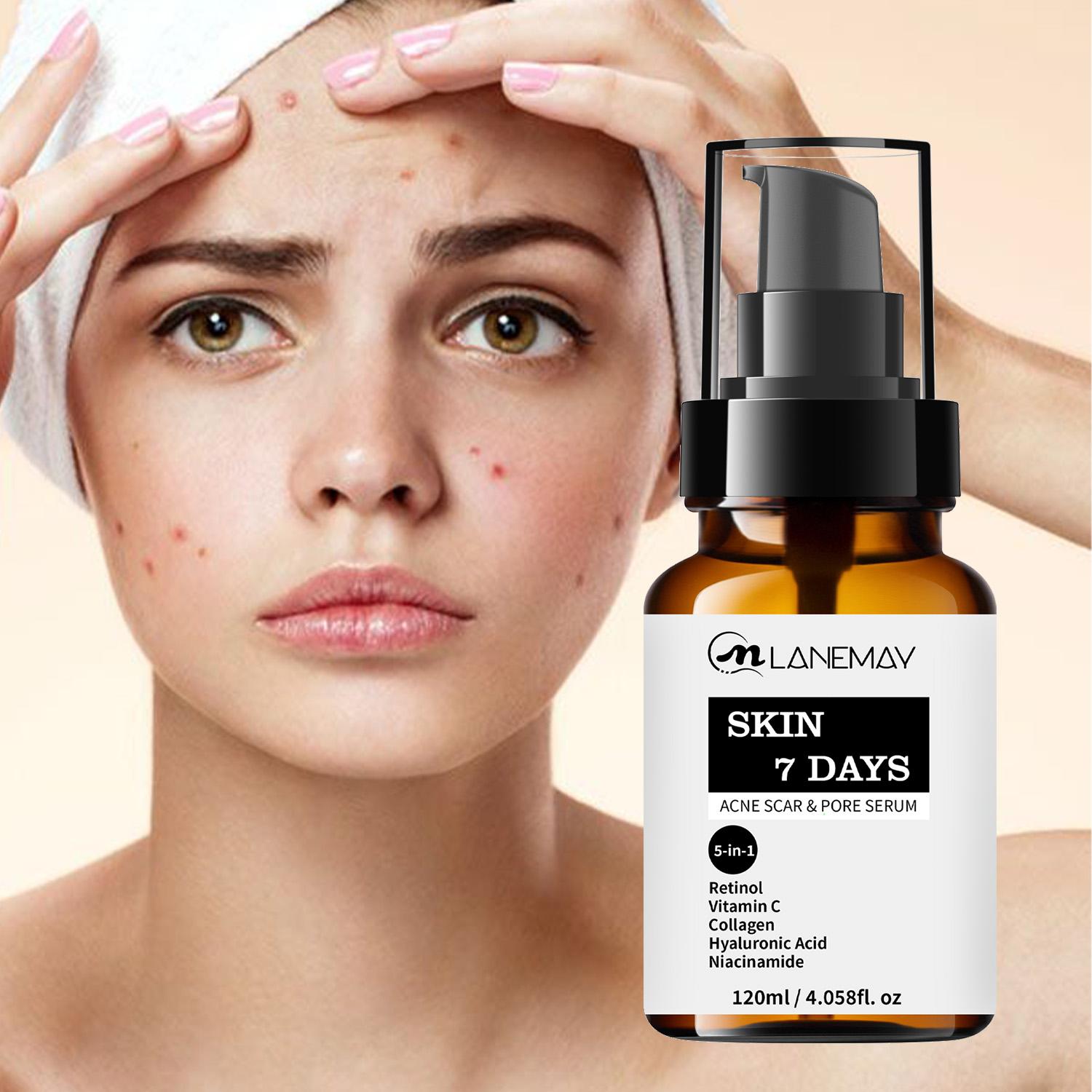 Acne Scar & Pore Serum- Reduce Acne Scars,Shrinks Pores, Balances Oil and Water, Prevents Acne - Suitable for Sensitive Skin, 120ml
Acne Scar & Pore Serum- Reduce Acne Scars,Shrinks Pores, Balances Oil and Water, Prevents Acne - Suitable for Sensitive Skin, 120ml