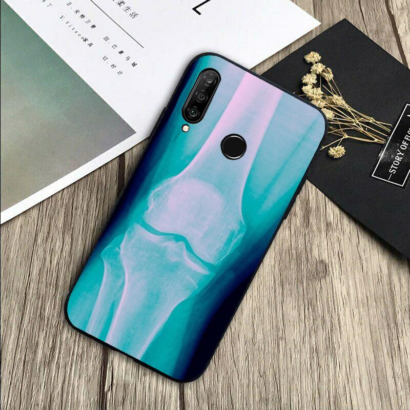 X-Ray Human Anatomy For Huawei Nova 5T 9 10 SE 7i 8i 11i 12i Y73 Y90 Y70 Y72 Y61 Y91 P60 Pro P40 P30 Lite Case Huawei P30 Lite
X-Ray Human Anatomy For Huawei Nova 5T 9 10 SE 7i 8i 11i 12i Y73 Y90 Y70 Y72 Y61 Y91 P60 Pro P40 P30 Lite Case Huawei P30 Lite