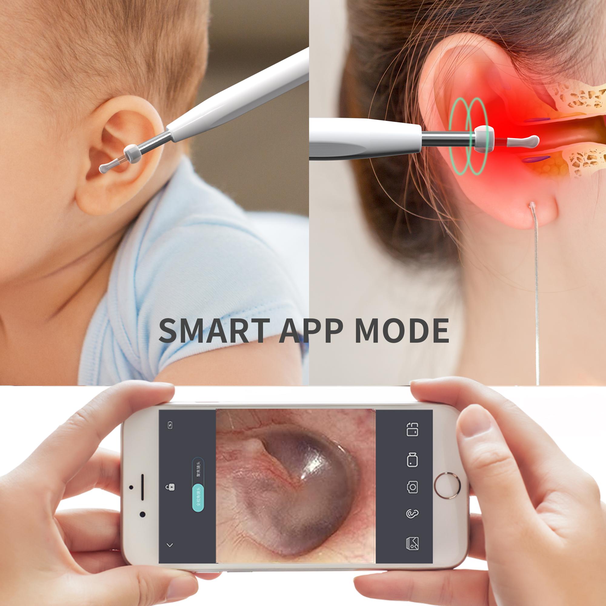 W2 Ear Camera Otoscope Ear Wax Removal Tool Kit LED Light Ear Pick Spoon Earwax Remover Black 
W2 Ear Camera Otoscope Ear Wax Removal Tool Kit LED Light Ear Pick Spoon Earwax Remover Black