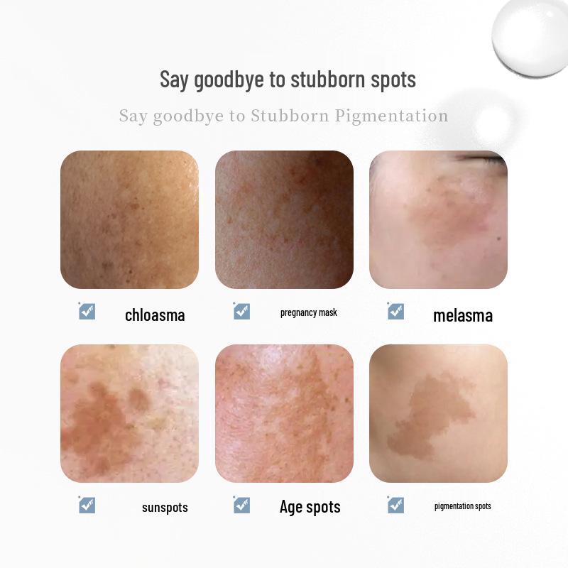 Guozhuang Brightening Arbutin Whitening Cream - Removes Yellow, Fades Spots, & Freckles
Guozhuang Brightening Arbutin Whitening Cream - Removes Yellow, Fades Spots, & Freckles