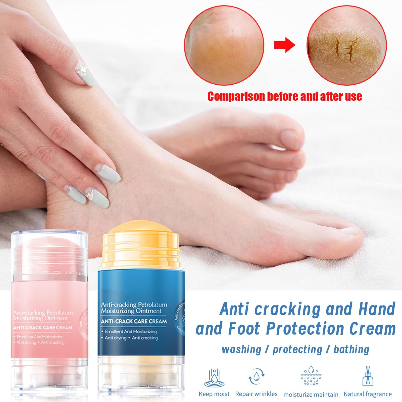 Petrolatum Special Cream Double Cream Anti-Freze Cracking And Anti-Sushion Cream для рук и ног One Size синий
Petrolatum Special Cream Double Cream Anti-Freze Cracking And Anti-Sushion Cream для рук и ног One Size синий