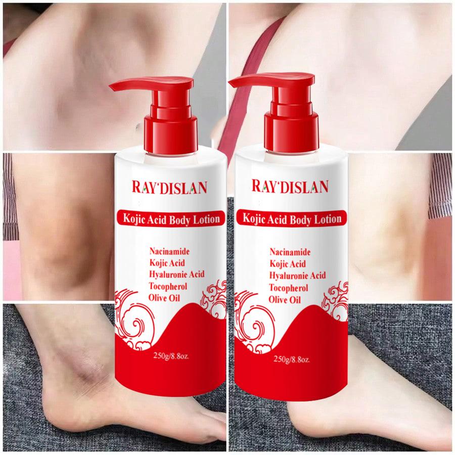 Kojic Acid Body Lotion With Glycolic Acid & Niacinamide, Hyaluronic Acid,Olive Oil Body Cream Deep Moisturizing Formula for Body Providing Hydration
Kojic Acid Body Lotion With Glycolic Acid & Niacinamide, Hyaluronic Acid,Olive Oil Body Cream Deep Moisturizing Formula for Body Providing Hydration