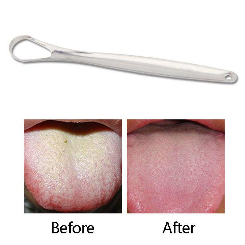 Bad Breath Coating Cleaner Remove Tongue Dirt Tongue Scraper Oral Hygiene Cleaning Brush Oral Care
Bad Breath Coating Cleaner Remove Tongue Dirt Tongue Scraper Oral Hygiene Cleaning Brush Oral Care