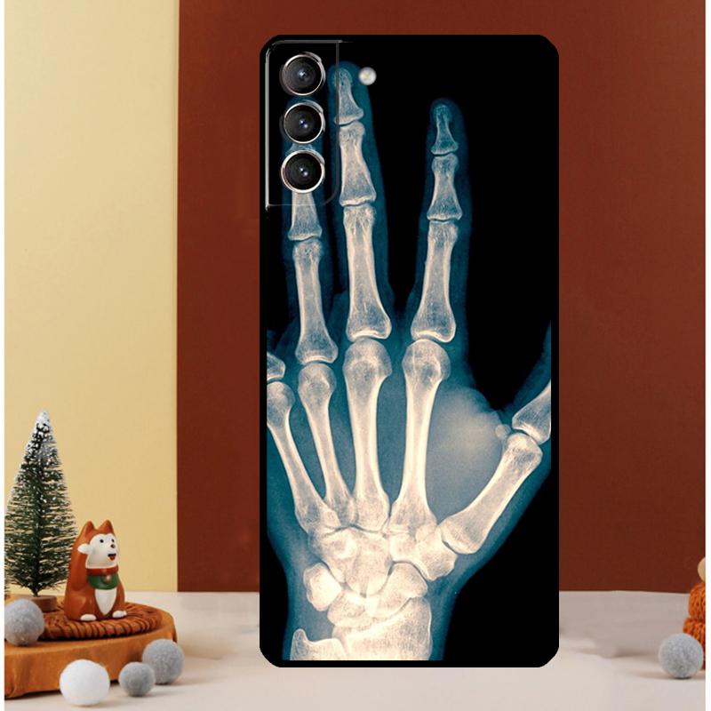 X-Ray Human Anatomy Case For Samsung Galaxy S25 S26 Ultra S20 S21 S22 S23 S24 Ultra S10 Plus S25 FE Cover Funda Galaxy S20 Plus
X-Ray Human Anatomy Case For Samsung Galaxy S25 S26 Ultra S20 S21 S22 S23 S24 Ultra S10 Plus S25 FE Cover Funda Galaxy S20 Plus