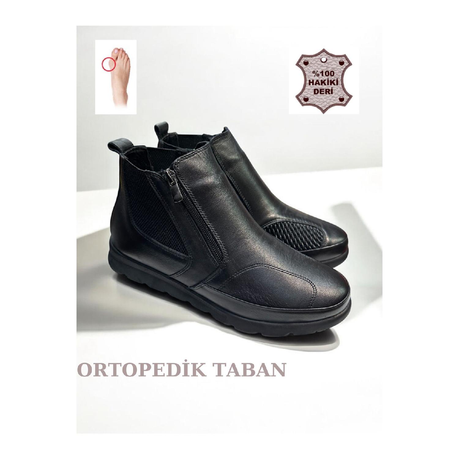 Full Orthopedic Base Genuine Leather Kaymaz Base Hallucus Valgus Bone Protrusion Mother Boat 37 чорний
Full Orthopedic Base Genuine Leather Kaymaz Base Hallucus Valgus Bone Protrusion Mother Boat 37 чорний