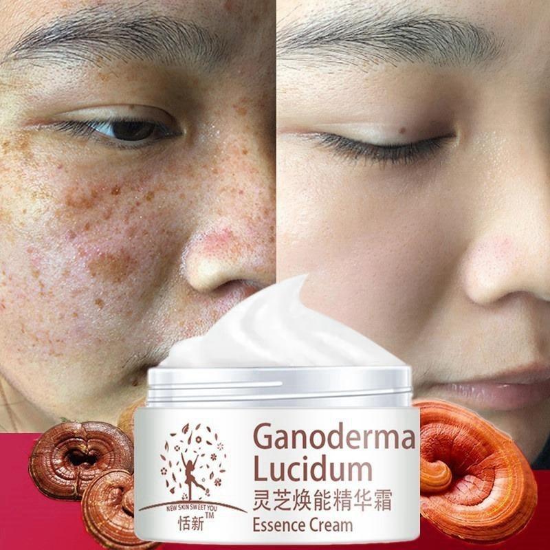 Крем для лица Ganoderma, удаление веснушек, восстанавливающий увлажняющий осветляющий крем для лица, антивозрастной крем Lucidum 5G
Крем для лица Ganoderma, удаление веснушек, восстанавливающий увлажняющий осветляющий крем для лица, антивозрастной крем Lucidum 5G