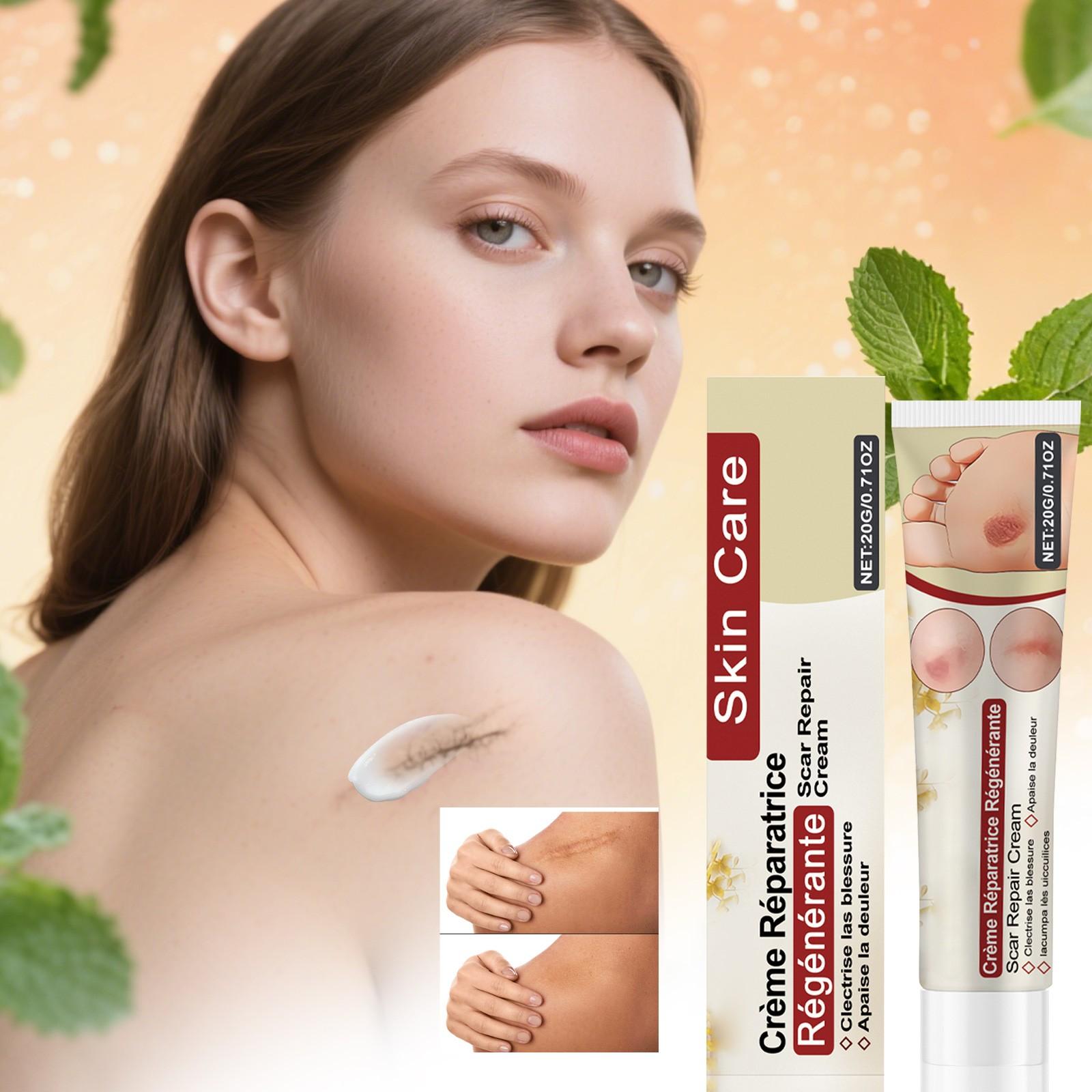 Крем от шрамов — это крем для ухода за кожей, предназначенный для улучшения внешнего вида шрамов и разглаживания кожи. One Size белый
Крем от шрамов — это крем для ухода за кожей, предназначенный для улучшения внешнего вида шрамов и разглаживания кожи. One Size белый