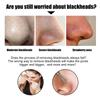 EELHOE Nose Patch Bamboo Charcoal Cleansing Blackhead Acne Pore Moisturizing Refreshing Oil Control Daily Care Nose Mask Nose Patch