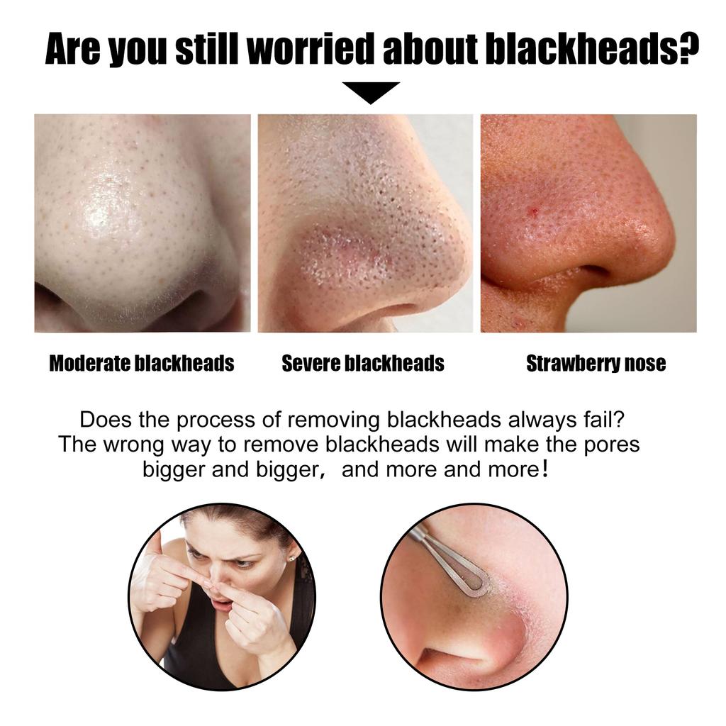 EELHOE Nose Patch Bamboo Charcoal Cleansing Blackhead Acne Pore Moisturizing Refreshing Oil Control Daily Care Nose Mask Nose Patch
