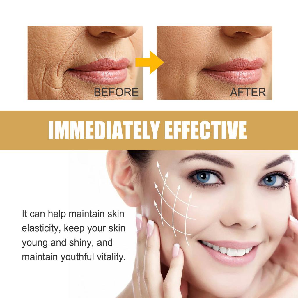 Eelhoe 24k Gold Anti-aging Patch For Fine Lines Nourishing Firming And Silky Smooth Skin