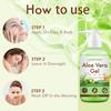 Aloe Vera Gel With Vitamin C & E - Deeply Hydrate and Moisturize Dry Skin, Improve Damaged Skin - Suitable for All Skin Types,200g