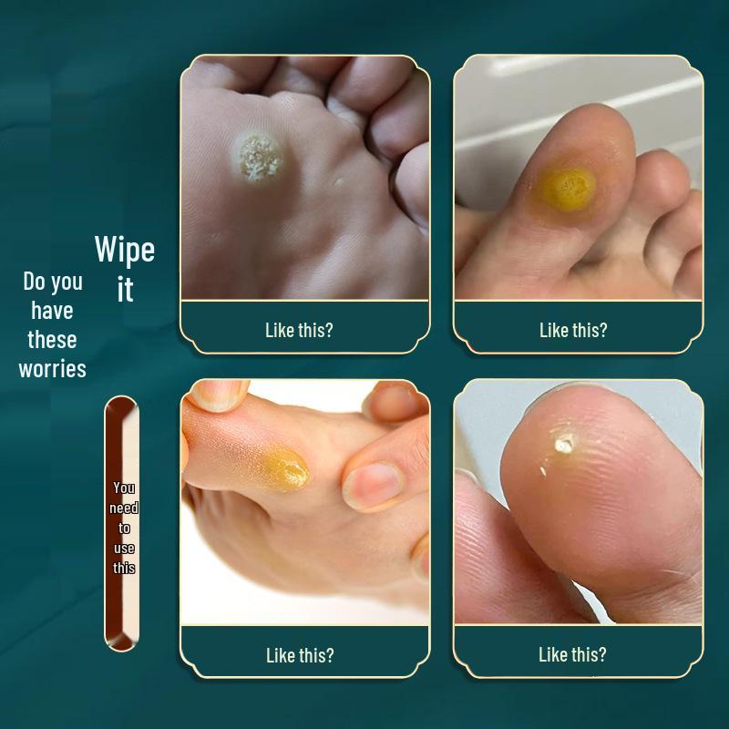 Doctor's Corn & Callus Remover Plaster for Foot Care