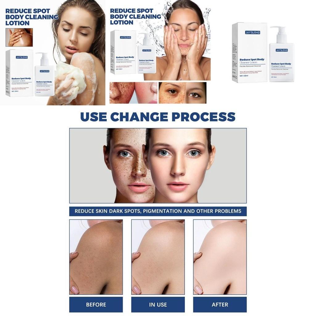Jaysuing Spot Cleanser Lotion 150ml For Deep Facial And Body Cleansing To Brighten And Fade Spots