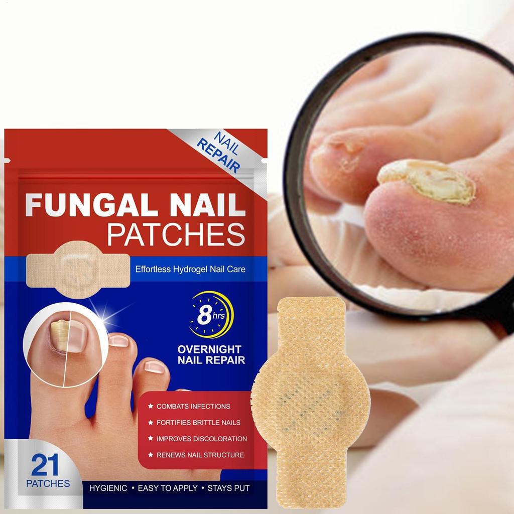 21 STÜCKE Nagelpflege-Patches Nagelreparatur-Patches Stellen gesundes Aussehen wieder her Zehennagelaufkleber Professionelle Wickel für Pediküre-Vorbereitung