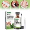 Conjunto Avançado Ximonth para Reparação de Unhas dos Pés e das Mãos para Cuidado de Unhas Saudáveis e Bonitas