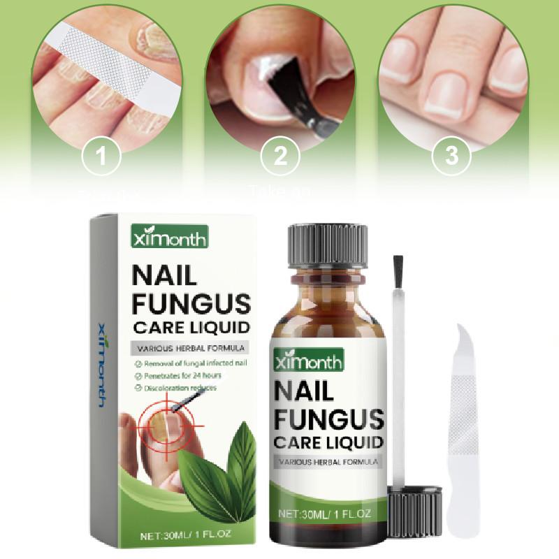Conjunto Avançado Ximonth para Reparação de Unhas dos Pés e das Mãos para Cuidado de Unhas Saudáveis e Bonitas