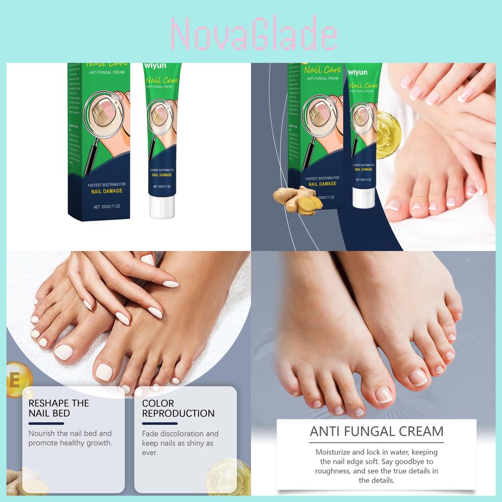 Nourishing Wiyun Nail Care Repair Cream For Shiny Healthy Nails And Soothing Comfort