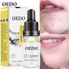 Oligopeptide Placenta Extract Hyaluronic Acid Anti-Acne Whitening Anti-Aging Anti-Wrinkle Smooth Skin Moisturizing Essence