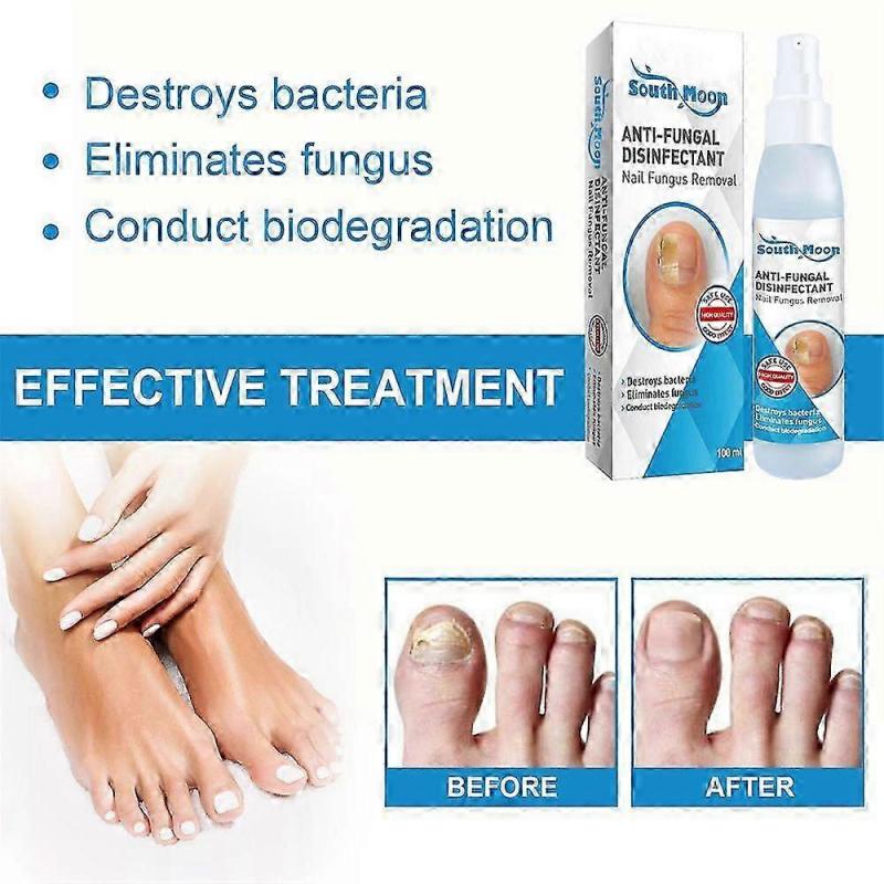3pcs Nail Repair Spray Repair And Clean Nails, Hands, Feet, Soft Nails, Thicken Nails, Polish Nails 100ml
