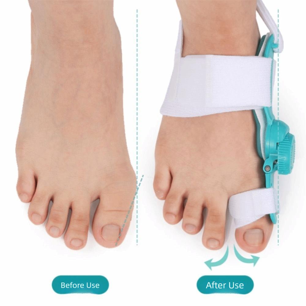 Bunion Splint Bunion Corrector Adjustable Foot Correction Brace Big Toe Straightener  Unisex