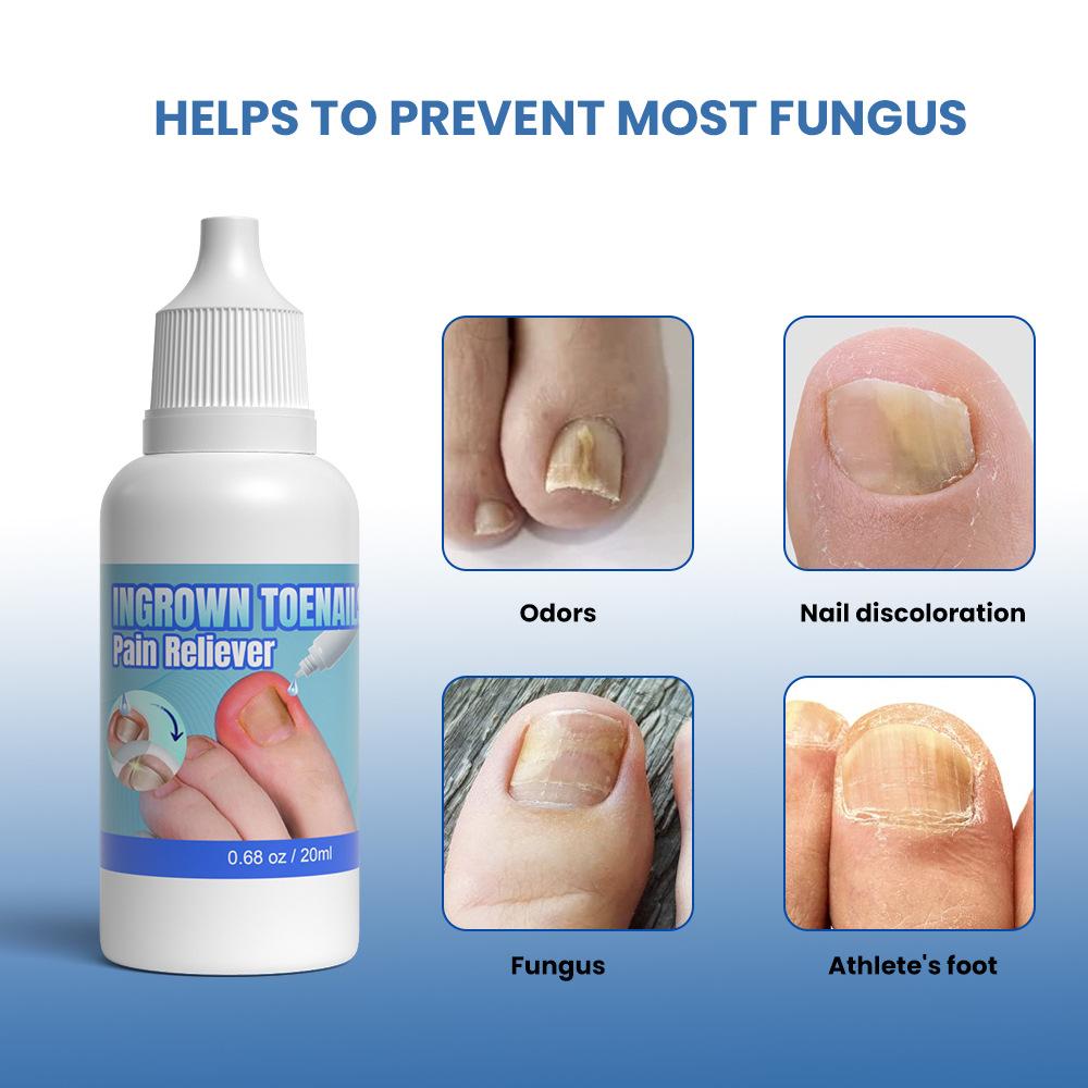 Sumifun 20/40 ML Gray Nails Repair Liquid Relieved Gray Stinky Nail Nourish Moisturize Nails Summer Essential