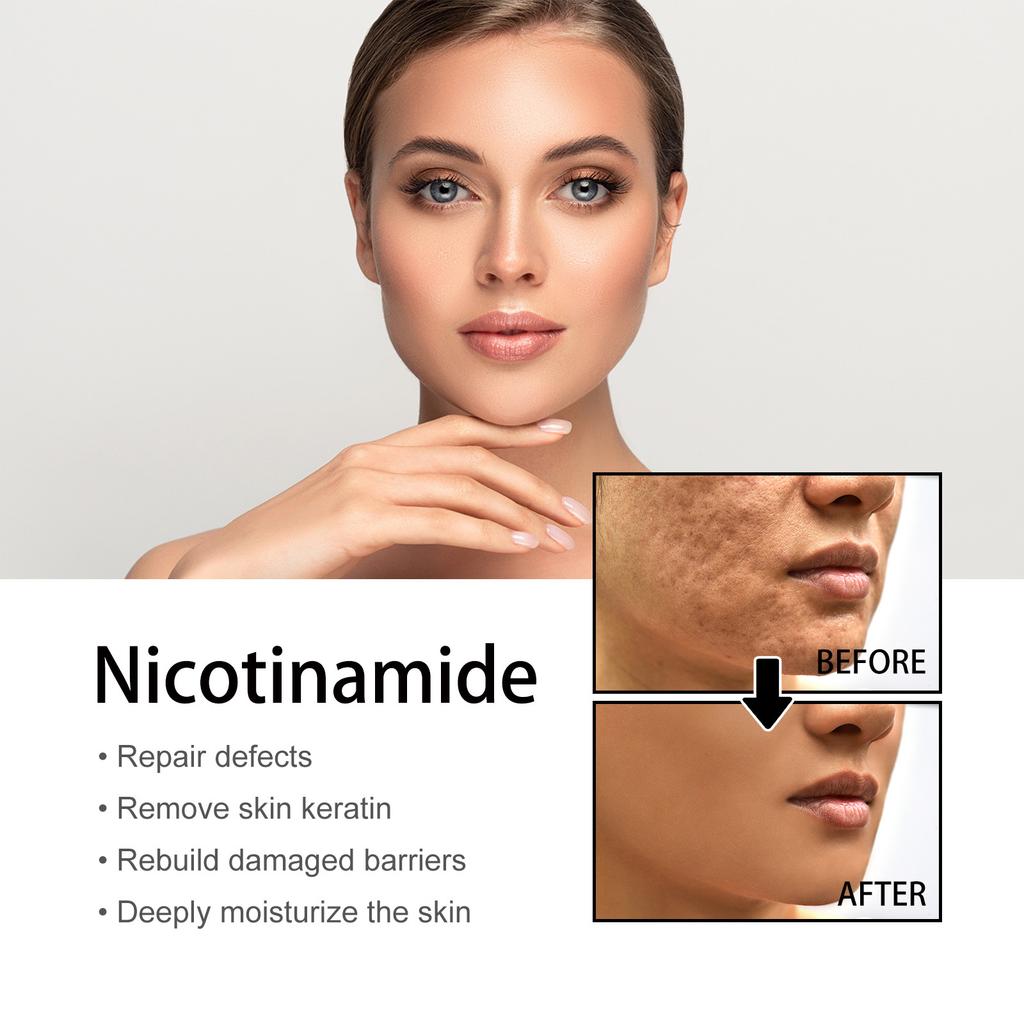 EELHOE Niacinamide Face Serum Whitening Anti Wrinkles Removal Spots Freckle Face Care Sodium Hyaluronate Facial Essence 50ml