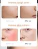 LED Light Therapy Face Mask for Acne Removal and Skin Rejuvenation