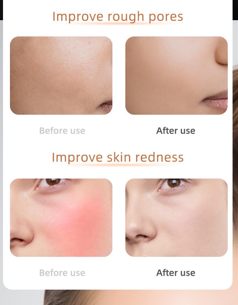 LED Light Therapy Face Mask for Acne Removal and Skin Rejuvenation