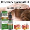 Eelhoe Hair Regenerating Essence 30ml, Scalp Care, Prevents Split Ends, Repairs Damaged Hair, 11x3x3cm