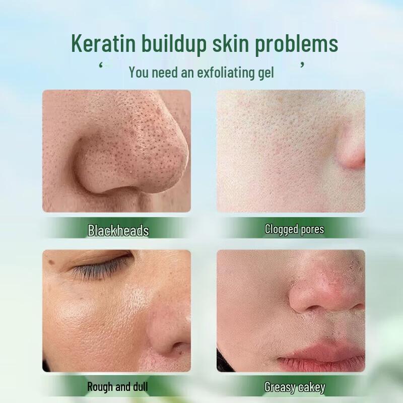 SEEDONVEUR Aloe Exfoliating Gel