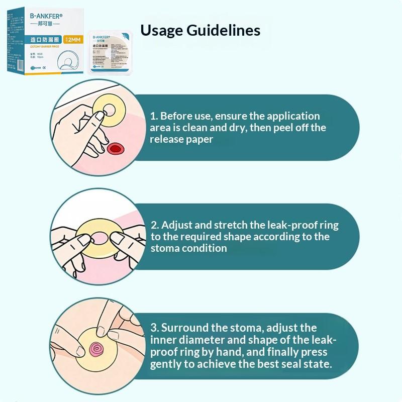 10Pcs Anti-Leakage Leak-Proof Ring For Colostomy Bag Ostomy Paste Ring Baseplates Stoma Care Products To Protect Skin 2/4Mm