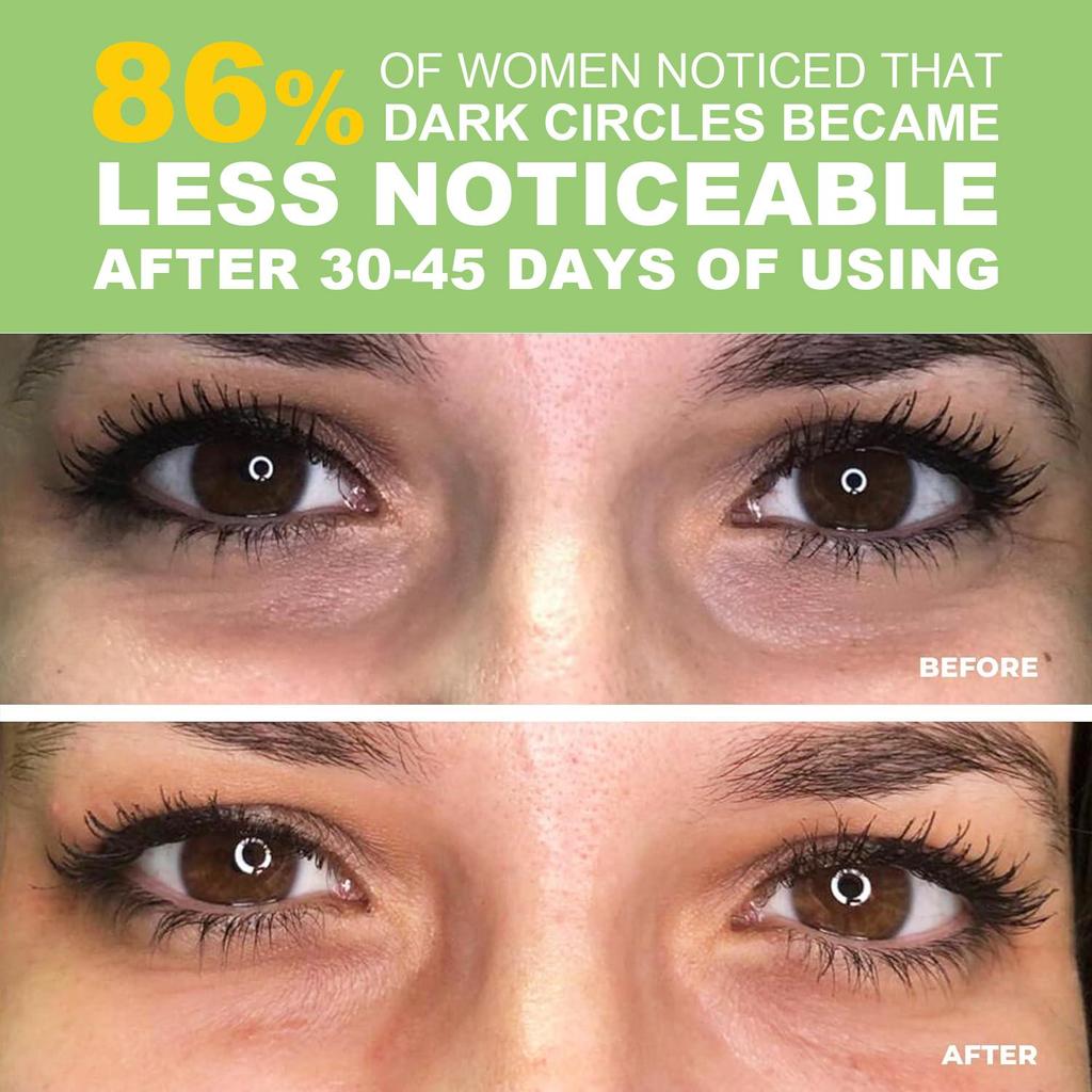 Green Tea Repair Eye Cream-Tightens Skin, Reduce Fine Lines & Dark Circles Under Eyes-Suitable For All Skin Types, 15ml