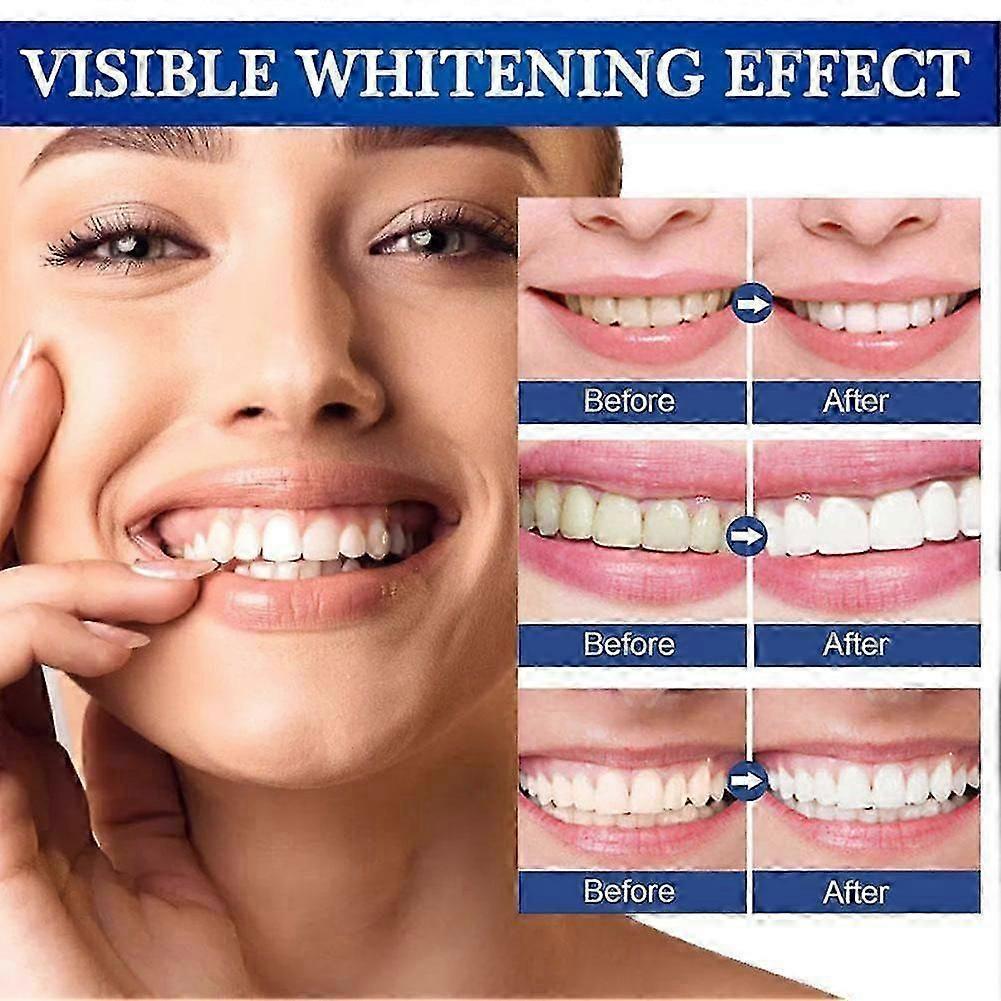 2x Teeth Whitening Pen Teeth Whitening Teeth Whitening Gel
