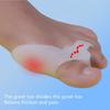 Toe Aligner Orthosis Seperator Separation Toe Design Comb Toe 2PC