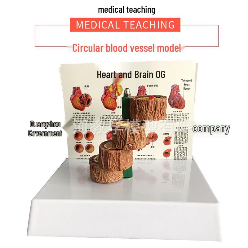 Elderly Heart & Atherosclerosis Teaching Model