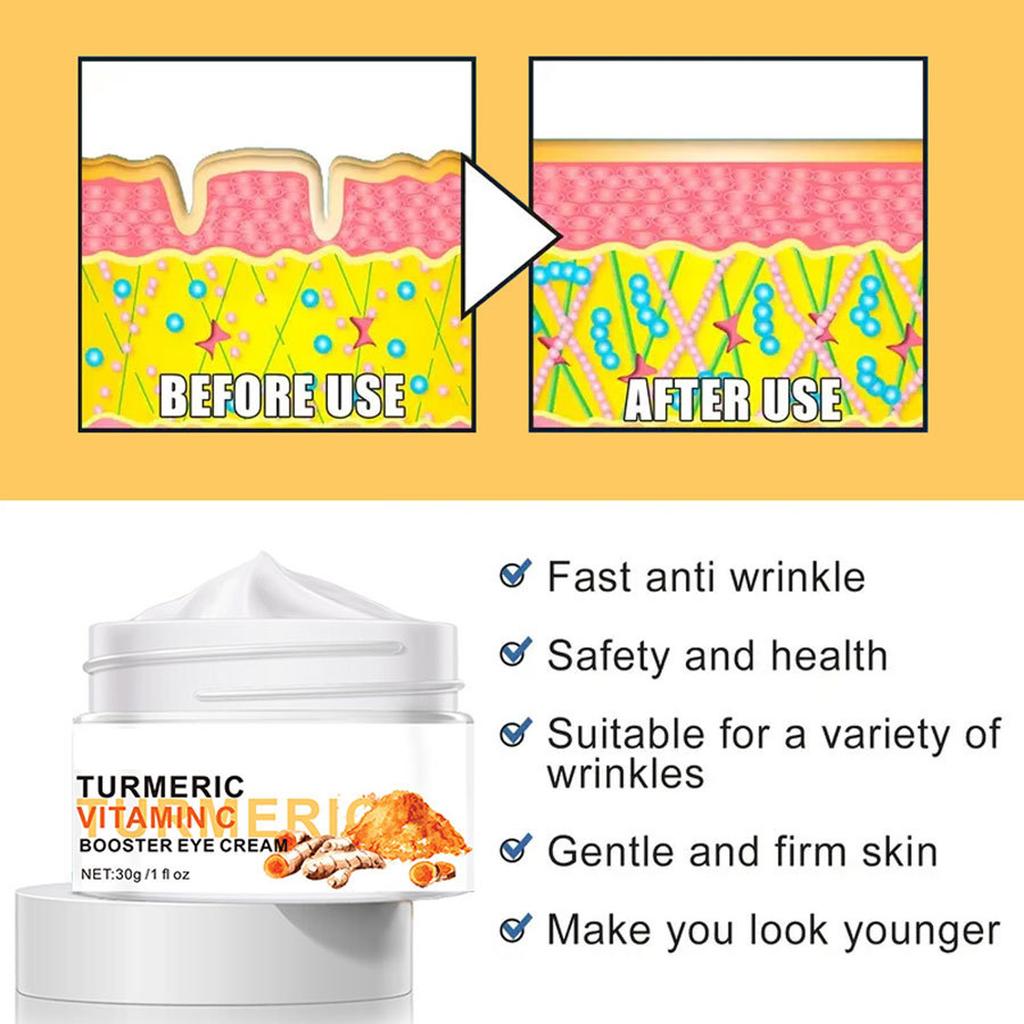Curcumin VC Eye Cream VC Brightening Eye Cream Moisturizes Fades Fine Lines And Lightens Black Circles Under The Eyes