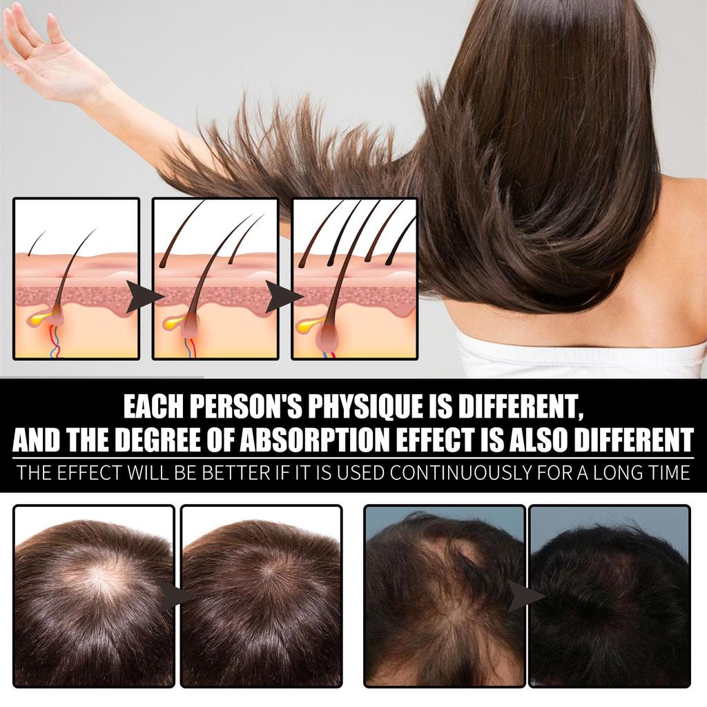 Collagen & Vitamin B7 Hair Oil, Nourishing & Gentle Hair Care, Softens & Smooths Hair