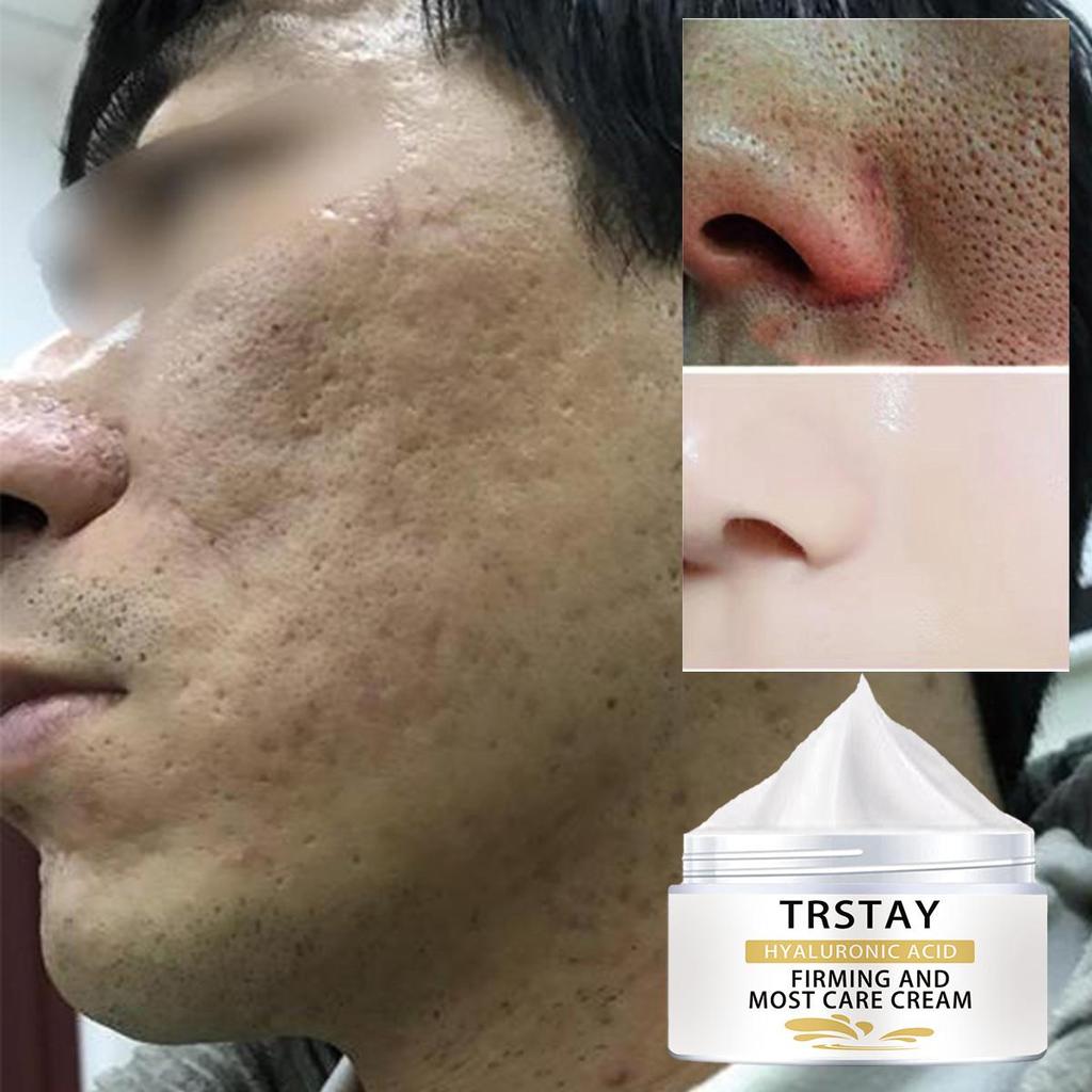 The Moisturizing Cream Is Gentle and Non-irritating, Hydrating, Nourishing and Brightening the Skin