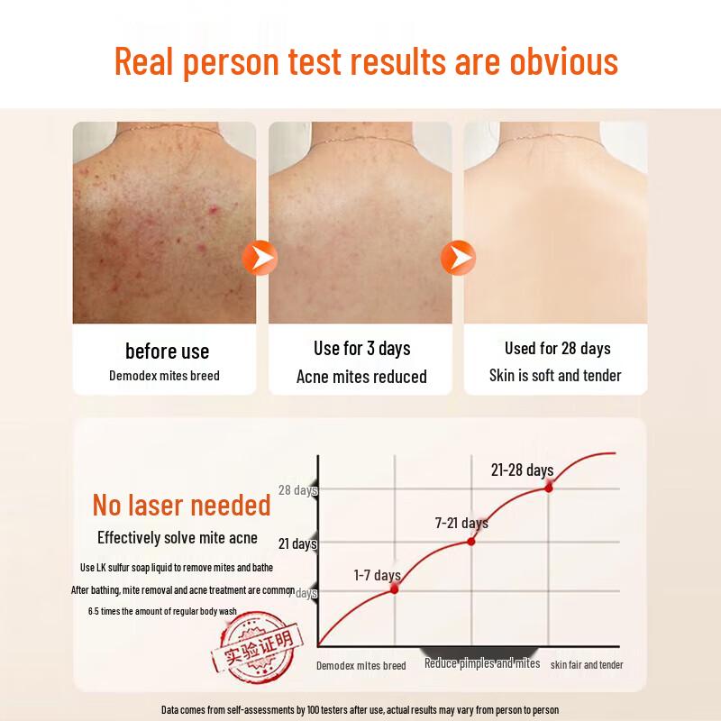LK Sulfur Hot Spring Anti-Mite Shower Gel