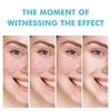 Acne Cream For Face Pimples Remover Treatment Shrink Pores Oil Control Lighten Acne Marks Whitening Smoothing Facial Skin Care